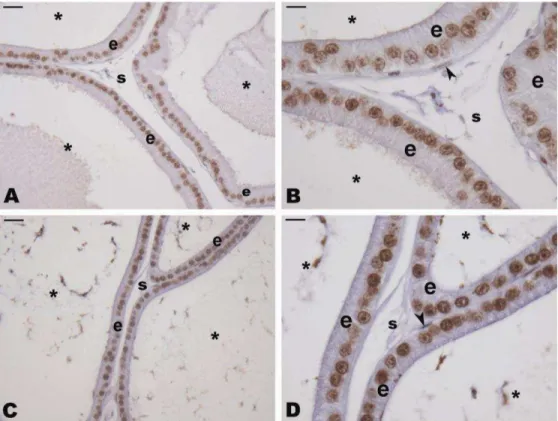 Figure  3.  Histological  sections  of  Wistar  rats’  ventral  prostate  after  AR  immunohistochemistry