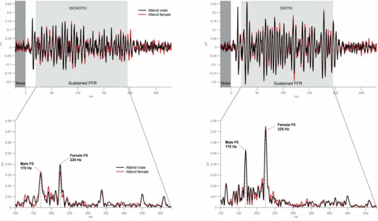 Figure 2. Frequency-following response reflects neural phase-locking to the fundamental frequency of male and female voice.