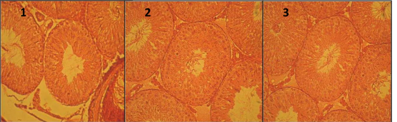 Figure  1.  Microscopic  slides  of  different  groups:  1  (control),  2  (100  mg/kg  of  celery  extract),  and  3  (200  mg/kg  of  celery  extract)