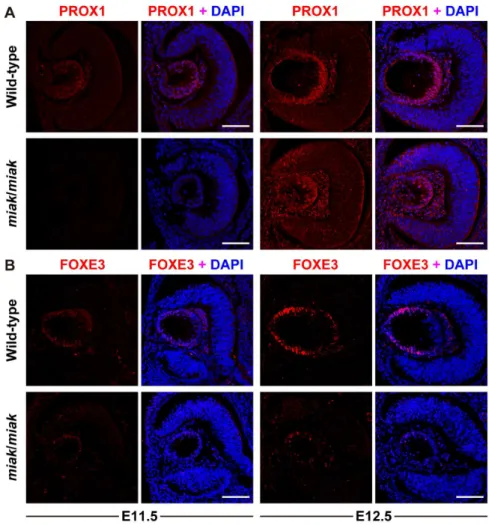 Figure 6. Localization and expression of the PROX1 (A) and FOXE3 (B) proteins during lens development in wild-type and miak mice at embryonic stages