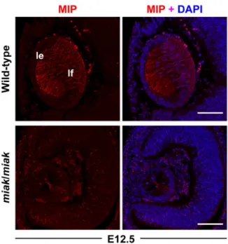 Figure 9. mRNA reduction of the crystallins in miak mice at embryonic stages. The relative levels of Cryaa, Cryab, Cryb1 and Cryga mRNA in the eye of wild-type (+/+) and miak/miak mice at E11.5, E12.5 and E14.5