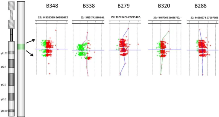 Table 3. Deletions and Duplications of 22q11.2 detected by targeted aCGH.