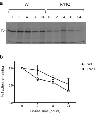 Fig 4. Effect of R41Q on PKLR protein stability. (a) Transiently transfected HEK293T cells expressing either the wild-type (WT) or the R41Q mutant PKLR proteins were metabolically labelled with [ 35  S]-methionine followed by chase in label-free media for 