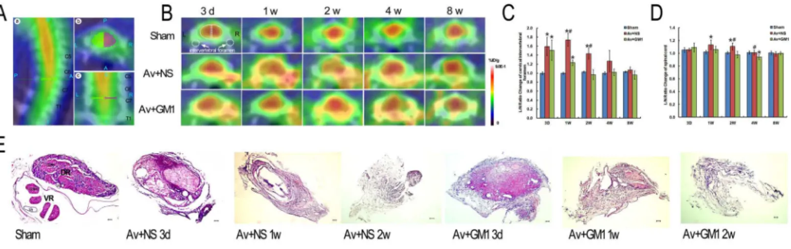 Fig 1. Higher 18 F-FDG accumulation in ipsilateral cervical intervertebral foramen and spinal cord was reduced by GM1 treatment in the rats with a right brachial plexus root avulsion injury at 3 d, 1 w, 2 w, 4 w, and 8 w post-injury
