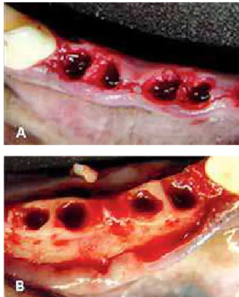 Fig. 1 One random hemi-arch was treated with the flapless approach (A) and the opposite hemi-arch was treated with a mucoperiosteal flap (B).