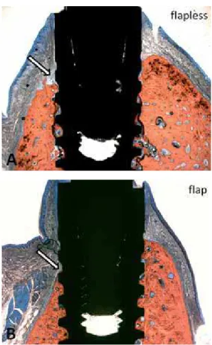 Fig.  3 After 12 weeks of immediate implantation the specimens were sectioned in bucco-lingual direction to compare buccal and lingual bone plate’s dimensions