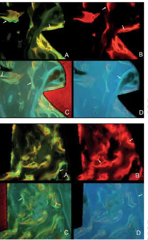 Fig. 5 Different bone markers at the coronal level of the implant. A: calcein green; B: red alizarin; C: oxytetracyclin; D: calcein blue