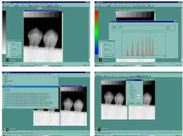 FIGURA 6 – Manuseio das imagens no programa Image Tool: a) imagem da dupla  de dentes na tela do programa Image Tool; b) padronização do  contraste  entre as radiografias utilizando o histograma na imagem  da escala de alumínio; c,d) seleção das ROI medind