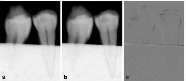 FIGURA 9 – Radiografias digitais para o tempo de aplicação ácida de 3,5 minutos: 