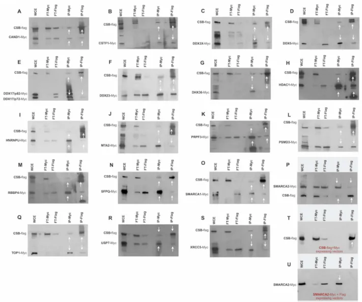 Fig 4. Co-immunoprecipitations studies. Co-immunoprecipitation was performed using the lysates of CSIAN cells, transiently expressing flag tagged CSB and myc-tagged proteins of interest