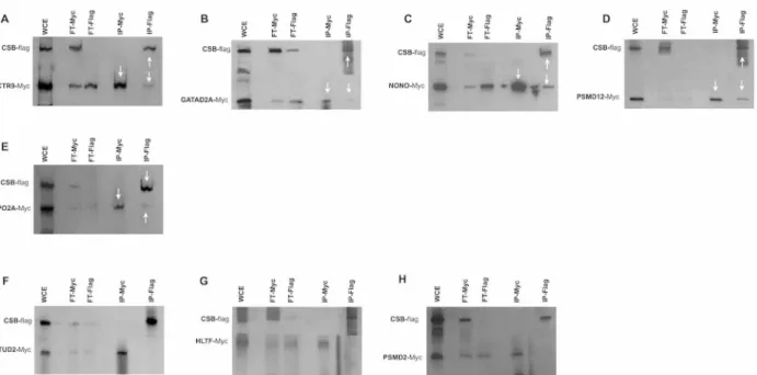 Fig 6. Co-immunoprecipitations studies. Co-immunoprecipitation was performed using the lysates of CSIAN cells, transiently expressing flag tagged CSB and myc-tagged proteins of interest