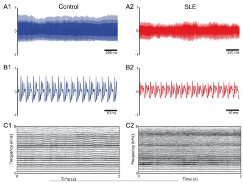 Figura 6 – Registros de voz e espectrogramas de pacientes com LES e grupo controle para a  gravação da vogal /a/ sustentada