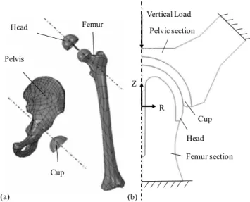 Fig. 10. Segmented hip joint model (model 2)