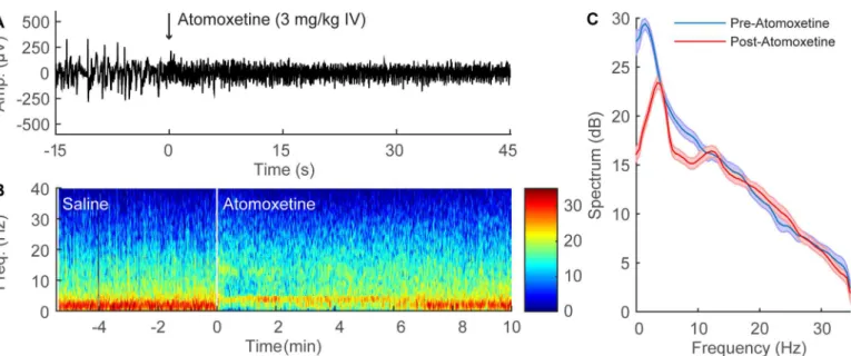 Fig 5. Atomoxetine administration induces significant EEG changes during continuous sevoflurane anesthesia