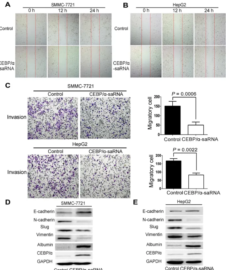Fig 3. Transfection of C/EBPα-saRNA in hepatoma cells inhibited migration, invasion and EMT