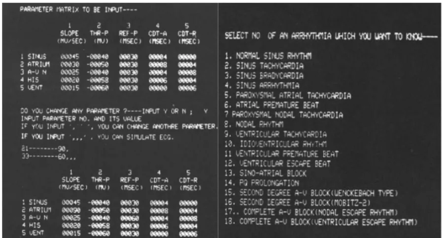 Figura 11 - Tela software S2 (FUKUSHIMA,1984). 