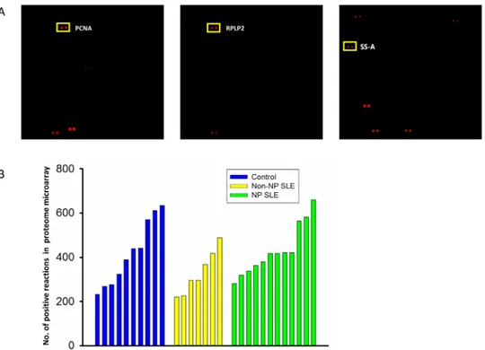 Fig 2. Detecting CSF autoantigens with the proteome microarray. (A). Representative scan images of a microarray, with target autoantigens in rectangles