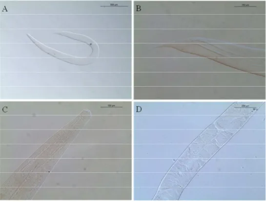 Figura 3. Raillietnema simples coletado de intestino grosso de Hypsiboas faber procedente  de  São  Luiz  do  Paraitinga,  SP