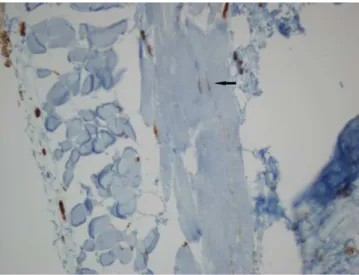 Figure 2. ICCs were not observed between muscles of the esophageal tissues in  the rat fetuses with EA, while there are many mast cells staining c-kit positive  (c-kit, x40)