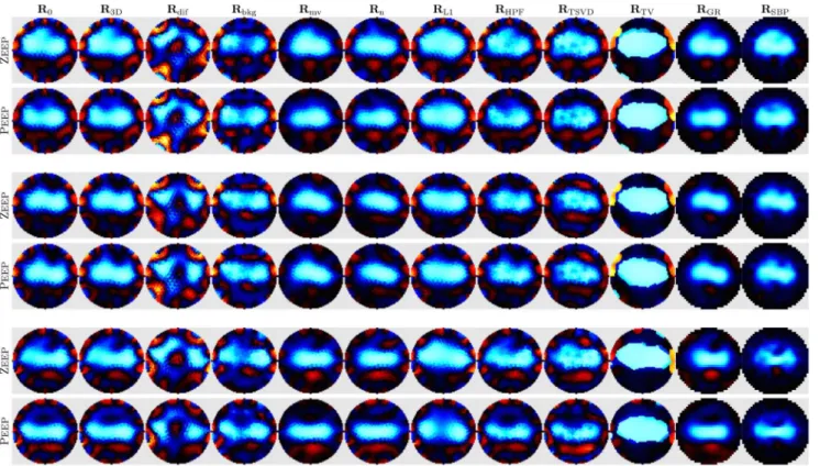 Figure 5. EIT images for all algorithms from three representative animals. For each animal, images of V T at Z EEP and P EEP are shown individually normalized to the maximum amplitude in each image (Blue: decrease in conductivity, Red: increase in conducti