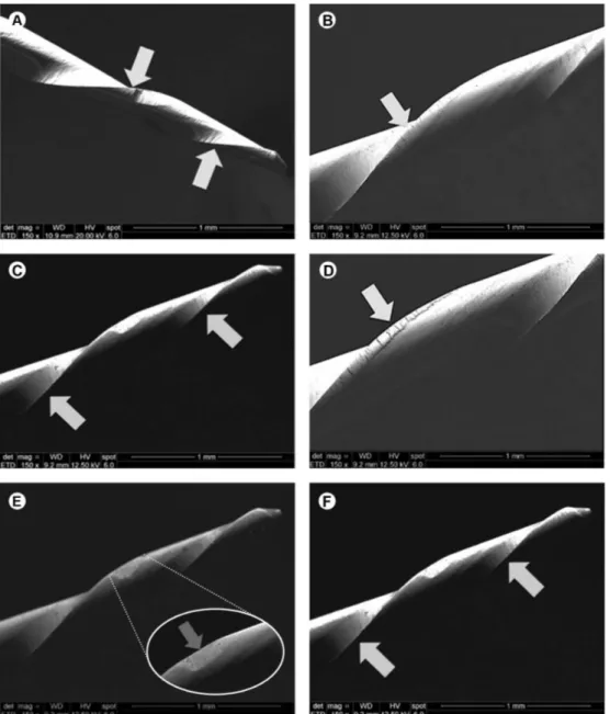 Figure 2. Superficial irregularities and debris observed on Reciproc instruments before use: irregular edges (A) and grooves (B); and after use: irregular  edges (C), grooves (D), microcavities (E) and burrs (F).