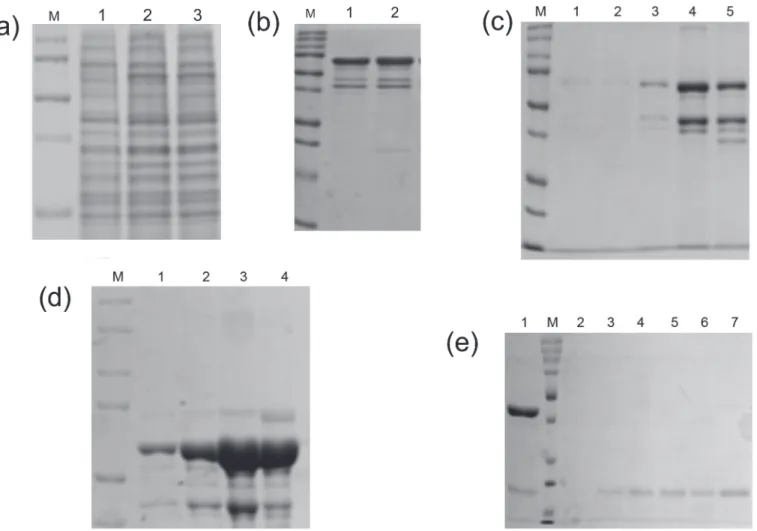 Fig 3. SDS-PAGE analysis of MBP-tagged dark ezrinABD. (a)12% SDS-PAGE gel showing the expression of 57 kDa protein, lane M; Protein marker, lane 1; Uninduced, lane 2; load, lane 3; Flowthrough, (b) MBP-tagged dark ezrinABD purified using Dextrin Sapharose,