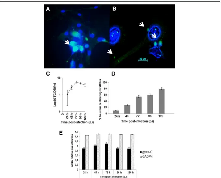 Figure 6 Identification of BoHV-5 infection. Detection of BoHV-5 antigens, viral DNA and glyco-C m RNA expression in infected bWJ-MSCs differentiated into neuron-like cells