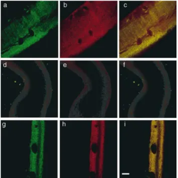 Figure 2. Costameric actin is absent from dystrophin-deficient m dx sarcolemma. Shown are representative images of  sarco-lemma isolated from control (a–c), dystrophin-deficient m dx (d–