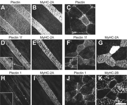 Figure 1.  Immunolocalization of plectin isoforms in quadri- quadri-ceps of 10-wk-old mice