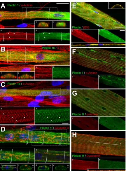 Figure 2.  Expression of full-length plectin isoforms in   differentiated myotubes and immunostaining of teased muscle  fi bers