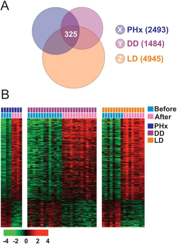 Figure 1. Hepatic injury and regeneration gene expression signature from human liver. (A) Venn diagram of human genes whose expression levels are significantly different before and after liver transplantation or partial hepatectomy
