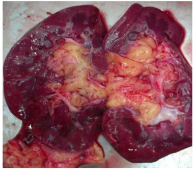 Figure 2. Congestion of kidneys due to boric acid toxicity on autopsy examination