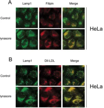 Figure 3. Dynasore treatment results in the endolysosomal accumulation of FC and LDL in HeLa cells