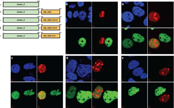 Figure 5. Homokaryon analysis revealed the existence of two independent NES-like signals in HBc ARD-II and ARD-IV