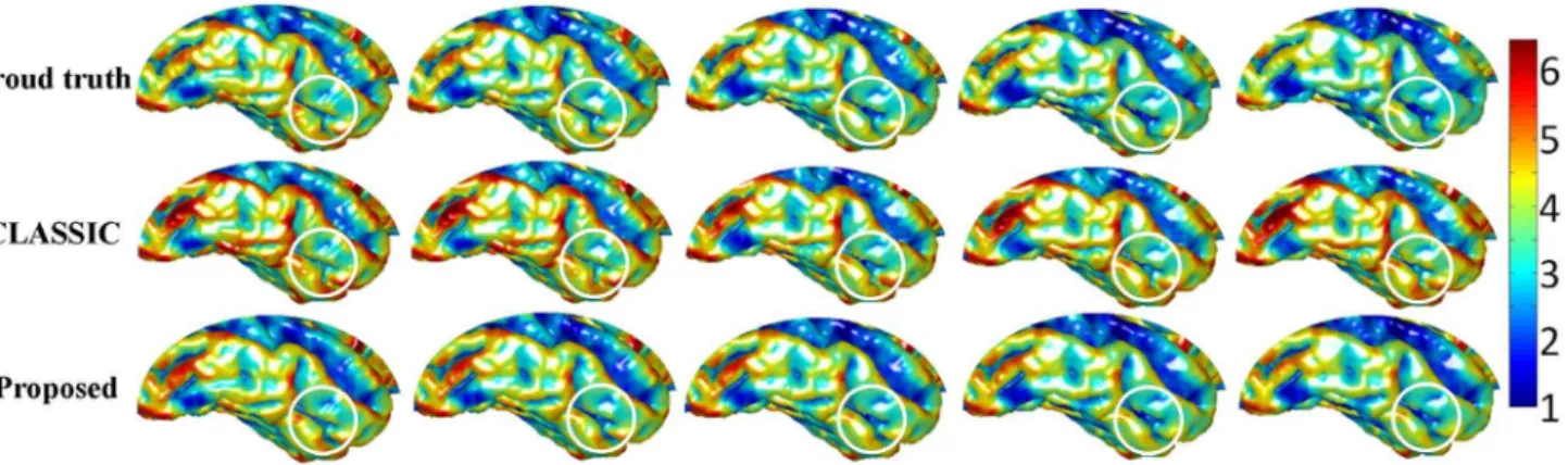 Figure 4. Rows from top to bottom show the cortical thickness maps of ground truth (1st row), thickness maps by CLASSIC (2nd row), and thickness maps by the proposed method (3rd row).