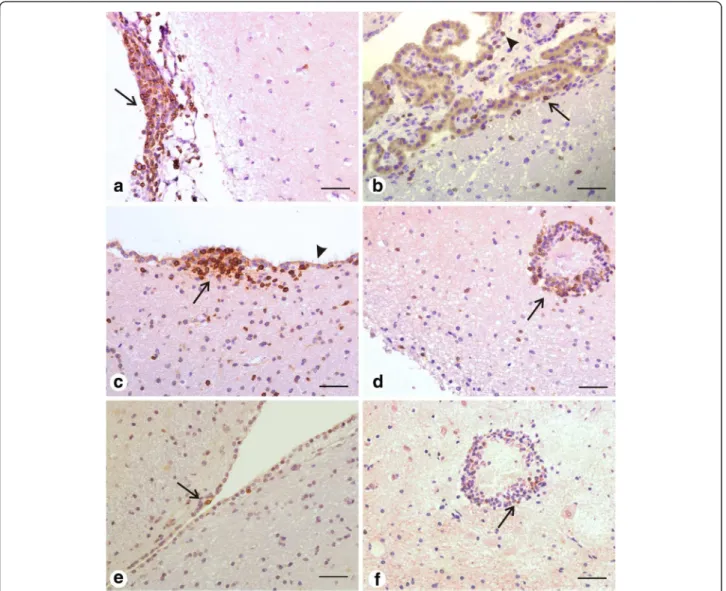 Figure 2 Representative photomicrographies of immunohistochemical detection of CD3 + and CD79α + lymphocytes within the nervous tissue of dogs (LTN group)