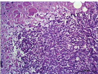 Figure 2. Large cell Lymphoma in the base of the dog’s tongue (HE, x200).