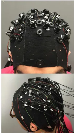 Fig 1. Left: EEG electrodes and fNIRS optodes configuration on the cap. Right: Real picture of a subject wearing the cap completely mounted (with EEG electrodes, fNIRS sources and detectors).