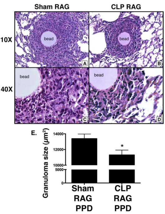 Figure 1. Decreased granuloma size in PPD-challenged CLP RAG lungs. RAG2 2/2 mice that received i.v