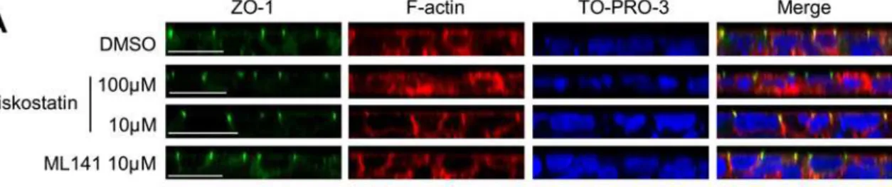 Fig 5. Pharmacological treatments decrease actin polymerization. (A) Cell shape, polarity and peripheral actin cytoskeleton pattern appear preserved upon 10 μM wiskostatin or 10 μM L141 treatments compared to vehicle treatment, whereas actin is scattered t