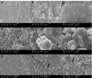 Figure 2. SEM micrographs of the specimens fracture surface,  with a magnification of 500x, 3000x and 5000x, in the first, second  and third column, respectively