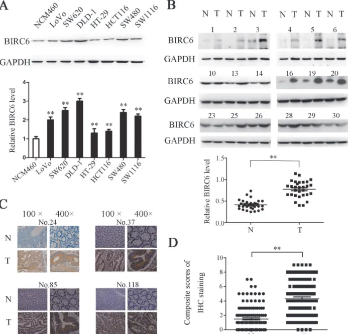 Fig 1. BIRC6 was overexpressed in CRC cell lines and tumor tissues of CRC patients. (A) Expression of BIRC6 in 1 human colon healthy cell line and 7 CRC cell lines