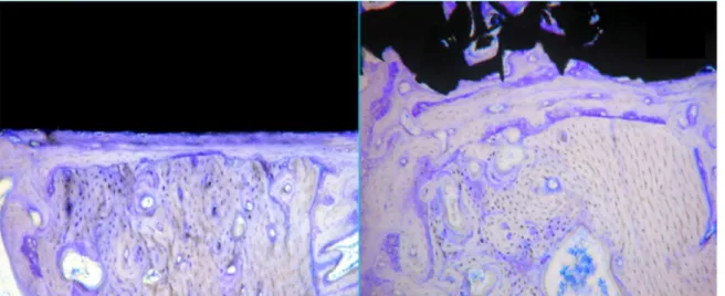Figure 7. Bone-implant interface at 8 weeks: a) osseointegration and new bone formation at the interface of dense implants (original  magnification 10x); b) bone in-growth into a porous surface titanium sample (original magnification 10x).