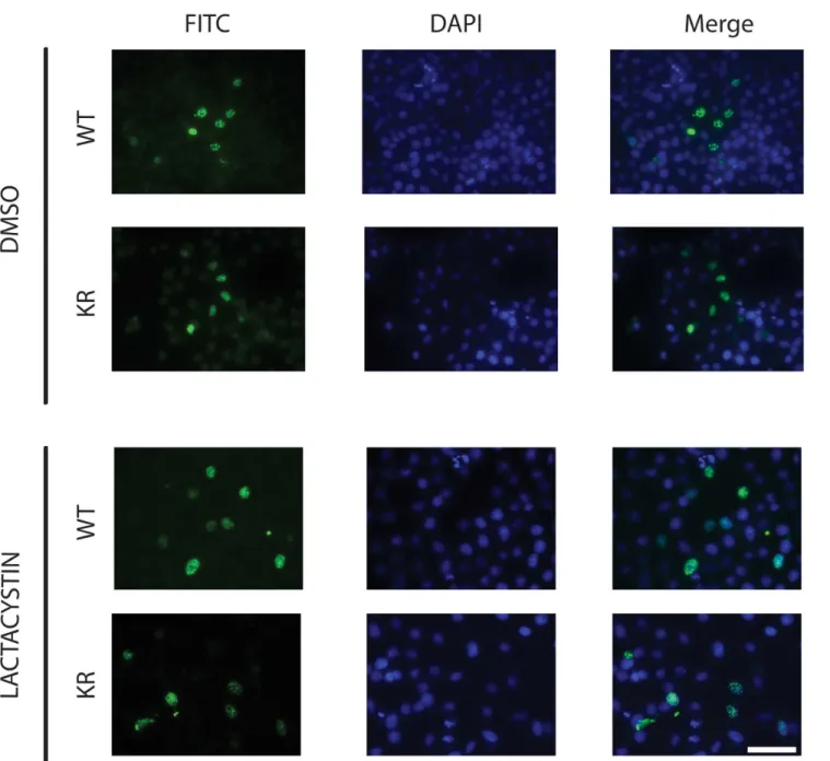 Fig 5. Localization of MAML1 in HeLa cells. MAML1 was mutated at various lysine residues as described in text