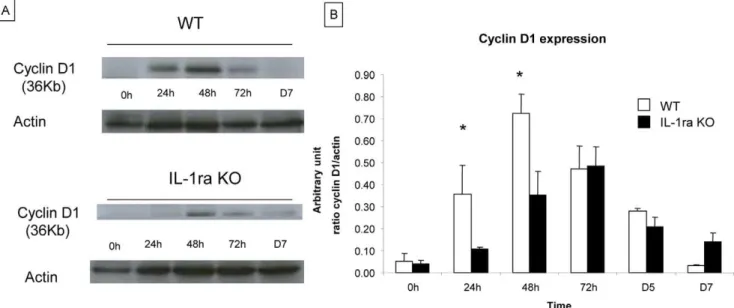 Figure 3. Analysis of Cyclin D1 expression in IL-1ra KO mice and in WT at early time points after hepatectomy