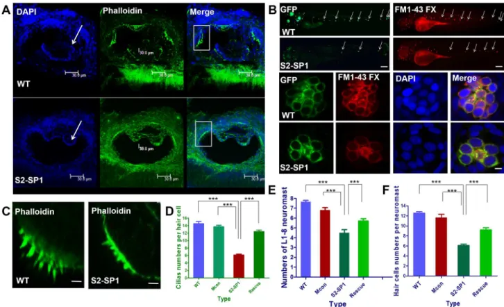 Fig 5. Knockdown of slc26a2 induces semicircular canal defects in larval zebrafish. (A) Changes in semicircular canal morphology and cilia size (scale bars = 30 μm)