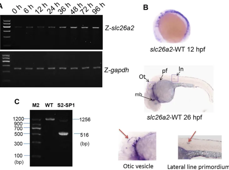 Fig 2. slc26a2 mRNA expression in embryonic and adult zebrafish. (A)RT-PCR analysis of slc26a2 expression in 0–96 h zebrafish yielded 405 bp products, GAPDH served as an internal control for cDNA quantification and gave a 275 bp product