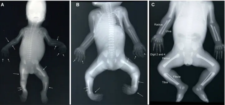 Figure 1.  Examples of fetuses that should be excluded and included from FA measurements