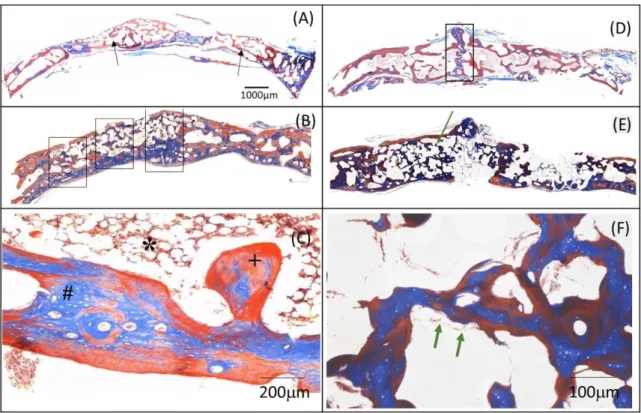Figure 7  shows the histomorphometry of the newly  formed bone and fibrovascular stroma (FS) for periods of  60 (Figure 7A) and 120 days (Figure 7B)