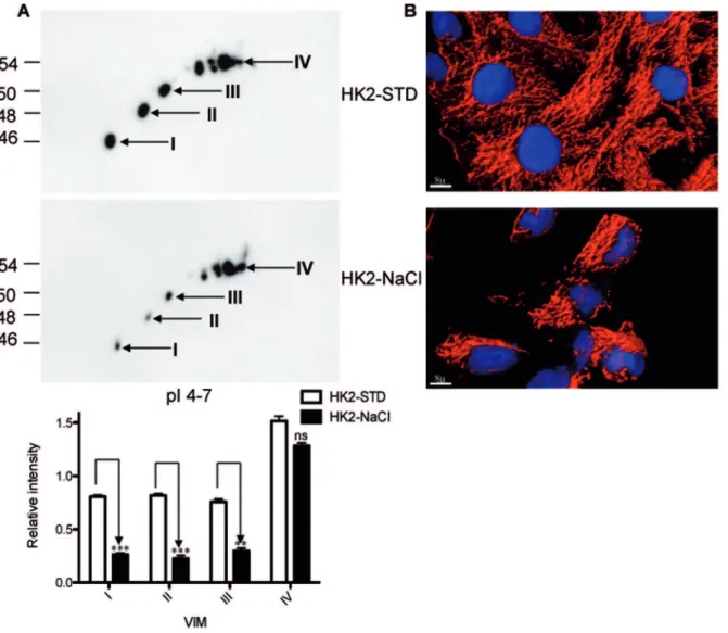 Figure 3. Differential expression of VIM forms under osmotic stress conditions in HK2renal epithelial cells